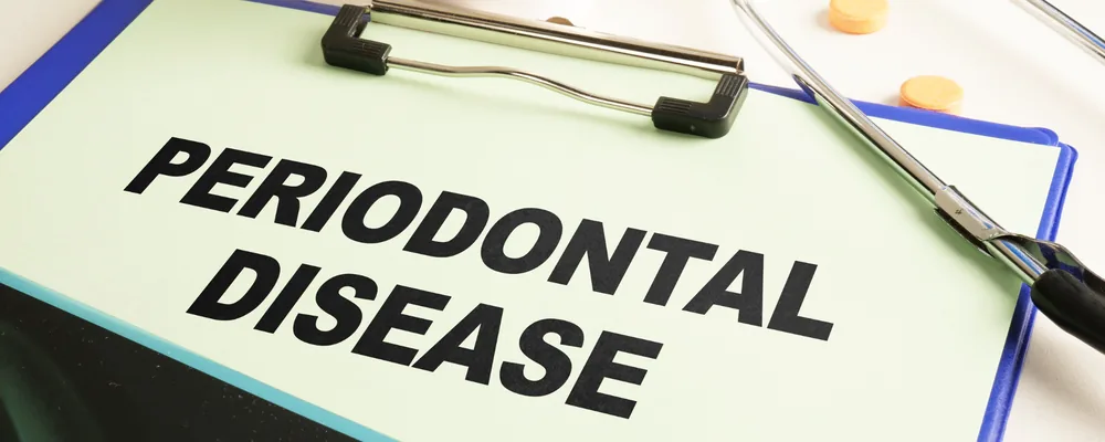 PERIODONTAL DISEASEと記されたカルテ用のボード｜アトレ五反田シティデンタルクリニック