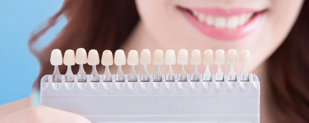 色の段階を細かく比べられるシェードガイドの接写｜アトレ五反田シティデンタルクリニック